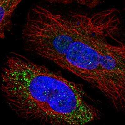 <b>Orthogonal Strategies Validation. </b>Immunocytochemistry/Immunofluorescence: SPINK5 Antibody [NBP1-90509] - Staining of human cell line HeLa shows localization to vesicles. Antibody staining is shown in green.