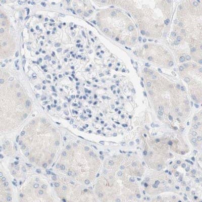 Immunohistochemistry-Paraffin: SPINK5 Antibody [NBP1-90509] - Staining of human kidney shows low expression as expected.