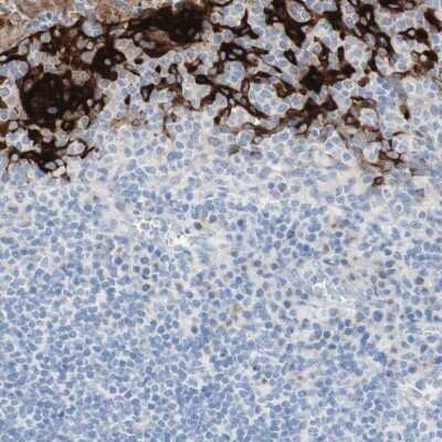 Immunohistochemistry-Paraffin: SPINK5 Antibody [NBP1-90509] - Staining of human tonsil shows high expression.