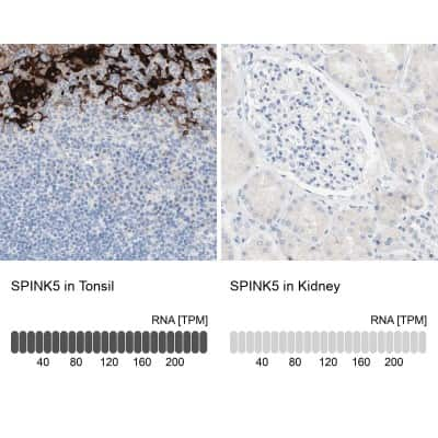 Immunohistochemistry-Paraffin: SPINK5 Antibody [NBP1-90509] - Staining in human tonsil and kidney tissues using anti-SPINK5 antibody. Corresponding SPINK5 RNA-seq data are presented for the same tissues.