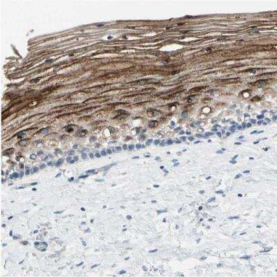 Immunohistochemistry-Paraffin: SPINK5 Antibody [NBP1-90510] - Staining of human uterine cervix shows moderate cytoplasmic positivity in squamous epithelial cells.