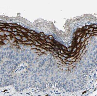 Immunohistochemistry-Paraffin: SPINK5 Antibody [NBP1-90510] - Staining of human skin shows strong cytoplasmic positivity in squamous epithelial cells.