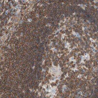 Immunohistochemistry SPINK6 Antibody