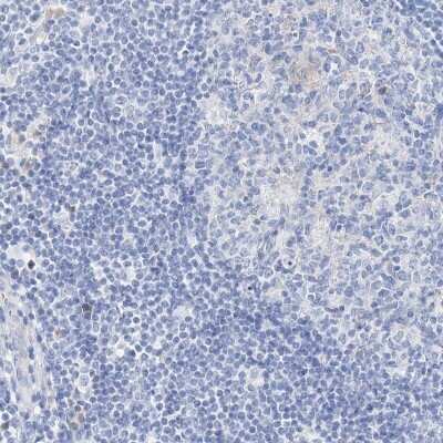 Immunohistochemistry-Paraffin: SPINK7 Antibody [NBP1-84015] - Staining of human lymph node shows low expression as expected.