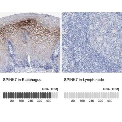 Immunohistochemistry-Paraffin: SPINK7 Antibody [NBP1-84015] - Staining in human esophagus and lymph node tissues using anti-SPINK7 antibody. Corresponding SPINK7 RNA-seq data are presented for the same tissues.