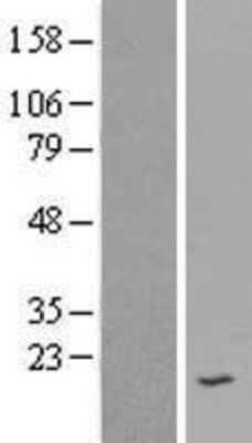 Western Blot: SPINK7 Overexpression Lysate (Adult Normal) [NBP2-05993] Left-Empty vector transfected control cell lysate (HEK293 cell lysate); Right -Over-expression Lysate for SPINK7.
