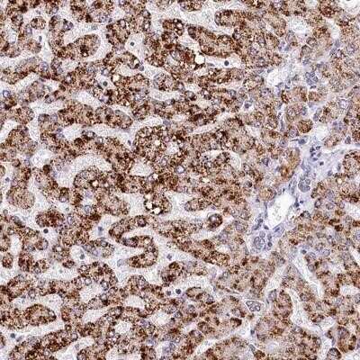 Immunohistochemistry-Paraffin: SPINK9 Antibody [NBP1-90990] - Staining of human liver shows strong cytoplasmic positivity in hepatocytes.