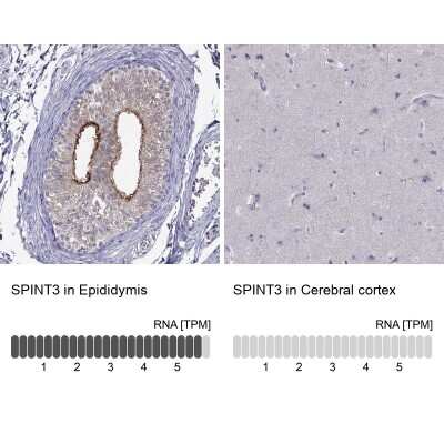 Immunohistochemistry-Paraffin SPINT3 Antibody - BSA Free