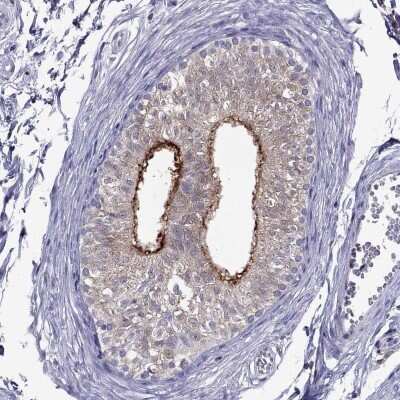 Immunohistochemistry-Paraffin SPINT3 Antibody - BSA Free