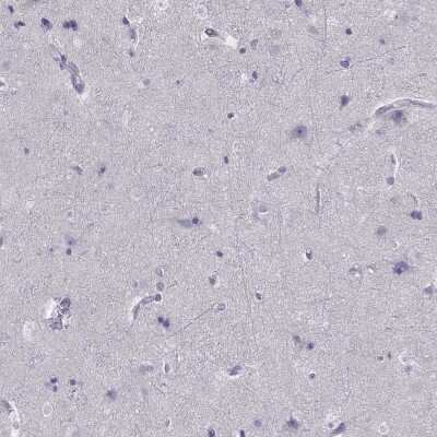 Immunohistochemistry-Paraffin SPINT3 Antibody - BSA Free