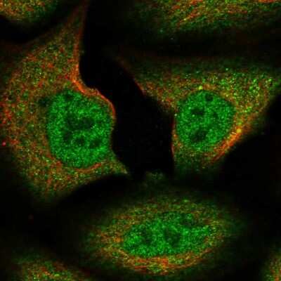 Immunocytochemistry/Immunofluorescence: SPIRE1 Antibody [NBP1-92438] - Staining of human cell line U-2 OS shows localization to nucleoplasm & cytosol.