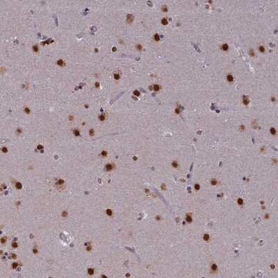 Immunohistochemistry-Paraffin: SPIRE1 Antibody [NBP1-92438] - Staining of human lateral ventricle shows strong nuclear positivity in neuronal cells.