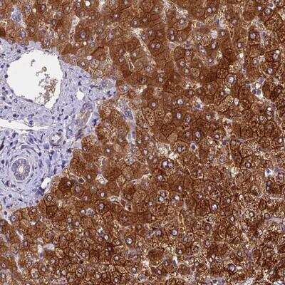 Immunohistochemistry-Paraffin: SPIRE1 Antibody [NBP1-92439] - Staining of human liver shows strong cytoplasmic and membranous positivity in hepatocytes.