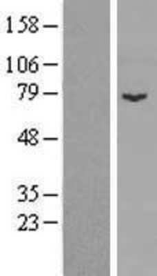 Western Blot: SPIRE1 Overexpression Lysate (Adult Normal) [NBP2-06666] Left-Empty vector transfected control cell lysate (HEK293 cell lysate); Right -Over-expression Lysate for SPIRE1.