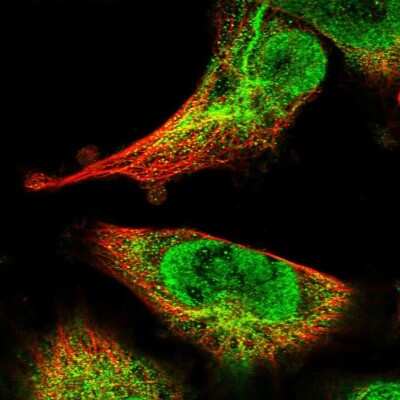 Immunocytochemistry/Immunofluorescence: SPIRE2 Antibody [NBP2-47261] - Staining of human cell line U-251 MG shows localization to nucleus, intermediate filaments & vesicles. Antibody staining is shown in green.