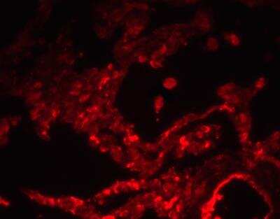 Immunohistochemistry SPNS1 Antibody - BSA Free