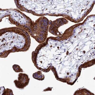 Immunohistochemistry-Paraffin: SPNS1 Antibody [NBP1-92440] - Staining of human placenta shows strong granular cytoplasmic positivity in trophoblastic cells.