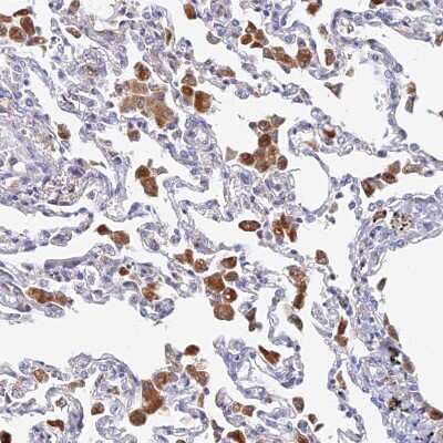 <b>Orthogonal Strategies Validation. </b>Immunohistochemistry-Paraffin: SPNS1 Antibody [NBP1-92441] - Staining of human lung shows moderate granular cytoplasmic positivity in macrophages.