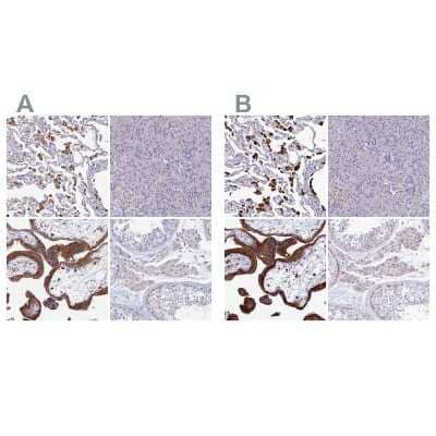 <b>Independent Antibodies Validation. </b>Immunohistochemistry-Paraffin: SPNS1 Antibody [NBP1-92441] - Staining of human lung, pancreas, placenta and testis using Anti-SPNS1 antibody NBP1-92441 (A) shows similar protein distribution across tissues to independent antibody NBP1-92440 (B).
