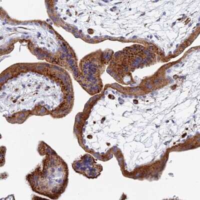 Immunohistochemistry-Paraffin: SPNS1 Antibody [NBP1-92441] - Staining of human placenta shows strong granular cytoplasmic positivity in trophoblastic cells.