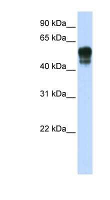 Western Blot: SPNS1 Antibody [NBP1-59999] - Transfected 293T cell lysate, concentration 0.2-1 ug/ml.