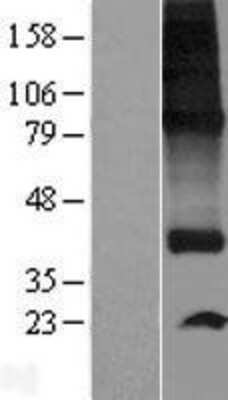 Western Blot: SPNS1 Overexpression Lysate (Adult Normal) [NBP2-06080] Left-Empty vector transfected control cell lysate (HEK293 cell lysate); Right -Over-expression Lysate for SPNS1.