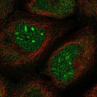 Immunocytochemistry/ Immunofluorescence SPOCD1 Antibody - BSA Free