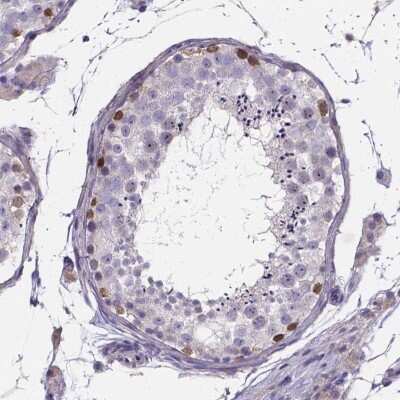 Immunohistochemistry SPOCD1 Antibody - BSA Free