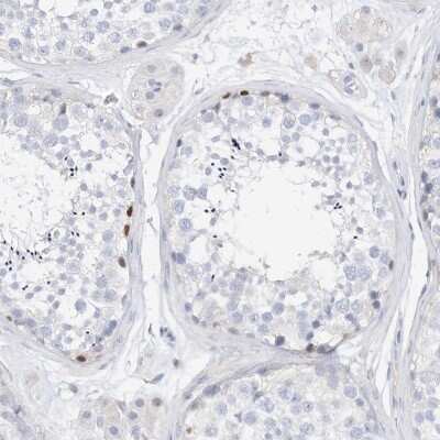 Immunohistochemistry-Paraffin SPOCD1 Antibody - BSA Free