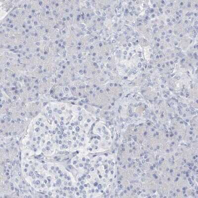 Immunohistochemistry-Paraffin SPOCD1 Antibody - BSA Free