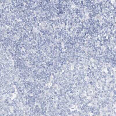 Immunohistochemistry-Paraffin SPOCD1 Antibody - BSA Free