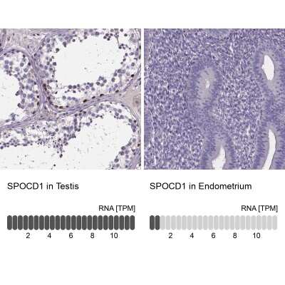 Immunohistochemistry-Paraffin SPOCD1 Antibody - BSA Free