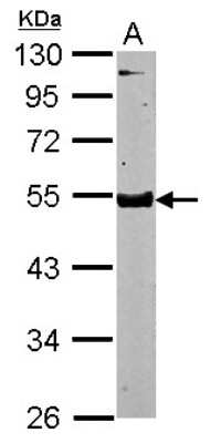 Western Blot: Testican 3/SPOCK3 Antibody [NBP2-20476] -  Sample (50 ug of whole cell lysate) A: Mouse Brain, 10% SDS PAGE gel, diluted at 1:5000.