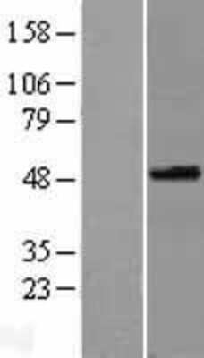 Western Blot: SPOCK3 Overexpression Lysate (Adult Normal) [NBL1-16416] Left-Empty vector transfected control cell lysate (HEK293 cell lysate); Right -Over-expression Lysate for SPOCK3.