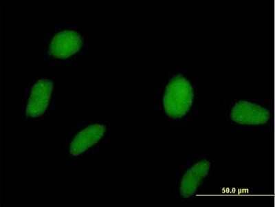 Immunocytochemistry/Immunofluorescence: SPOP Antibody [H00008405-B01P] - Analysis of purified antibody to SPOP on HeLa cell. (antibody concentration 10 ug/ml)