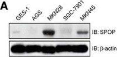 Western Blot: SPOP Antibody [H00008405-B01P] - SPOP inhibits gastric cancer cell proliferation and migration. The expression of SPOP protein in human GC cell lines - MKN45, MKN28, AGS, SGC7901, and human gastric mucosal cell line GES-1 by Western blotting. Image collected and cropped by CiteAb from the following publication (www.jeccr.biomedcentral.com/articles/10.1186/s13046-014-0075-8) licensed under a CC-BY license.