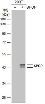 Western Blot: SPOP Antibody [NBP1-33090] - Non-transfected (-) and transfected (+) 293T whole cell extracts (30 ug) were separated by 10% SDS-PAGE, and the membrane was blotted with SPOP antibody [N1C1]  diluted at 1:5000. The HRP-conjugated anti-rabbit IgG antibody (NBP2-19301) was used to detect the primary antibody.