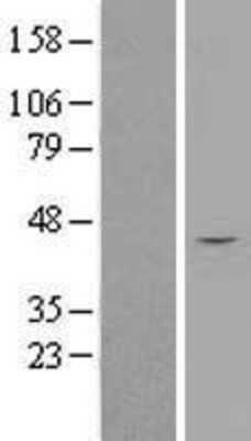 Western Blot: SPOP Overexpression Lysate (Adult Normal) [NBP2-08811] Left-Empty vector transfected control cell lysate (HEK293 cell lysate); Right -Over-expression Lysate for SPOP.