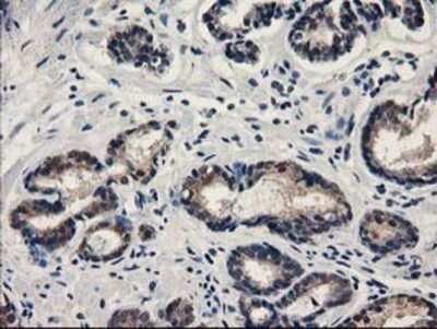 Immunohistochemistry: SPR Antibody (OTI4F5) - Azide and BSA Free [NBP2-74344] - Staining of paraffin-embedded Carcinoma of Human prostate tissue using anti-SPR mouse monoclonal antibody.