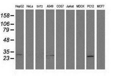 Western Blot: SPR Antibody (OTI4F5) - Azide and BSA Free [NBP2-74344] - Analysis of extracts (35ug) from 9 different cell lines by using anti-SPR monoclonal antibody.