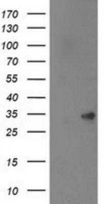 Western Blot: SPR Antibody (OTI4F5) - Azide and BSA Free [NBP2-74344] - HEK293T cells were transfected with the pCMV6-ENTRY control (Left lane) or pCMV6-ENTRY SPR (Right lane) cDNA for 48 hrs and lysed. Equivalent amounts of cell lysates (5 ug per lane) were separated by SDS-PAGE and immunoblotted with anti-SPR.