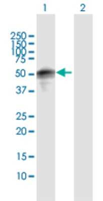 Western Blot: SPRED1 Antibody [H00161742-D01P] - Analysis of SPRED1 expression in transfected 293T cell line by SPRED1 polyclonal antibody.Lane 1: SPRED1 transfected lysate(50.50 KDa).Lane 2: Non-transfected lysate.