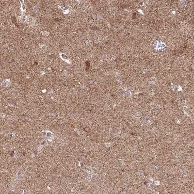 Immunocytochemistry/Immunofluorescence: SPRED2 Antibody [NBP2-68816] - Immunohistochemical staining of human cerebral cortex shows cytoplasmic positivity in neuronal and glial cells.