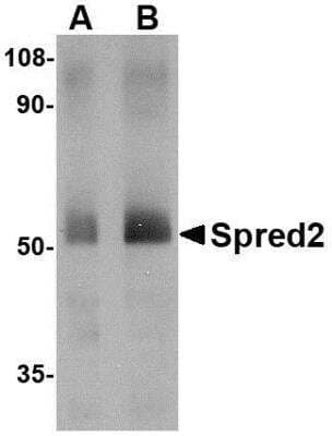 Western Blot: SPRED2 Antibody [NBP1-76342] - Human small intestine tissue lysate with Spred2 antibody at (A) 1 and (B) 2 ug/mL.