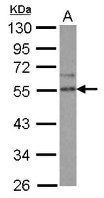 Western Blot SPRED2 Antibody