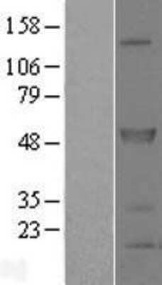 Western Blot SPRED2 Overexpression Lysate