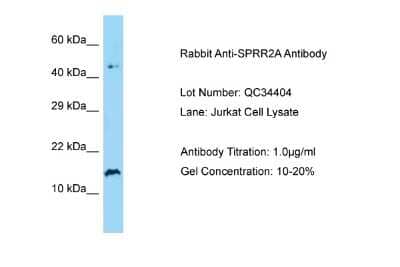 Western Blot: SPRR2A Antibody [NBP2-84281] - Host: Rabbit. Target Name: SPRR2A. Sample Type: Human Jurkat. Antibody Dilution: 1.0ug/ml