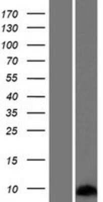 Western Blot: SPRR2G Overexpression Lysate (Adult Normal) [NBP2-08735] Left-Empty vector transfected control cell lysate (HEK293 cell lysate); Right -Over-expression Lysate for SPRR2G.