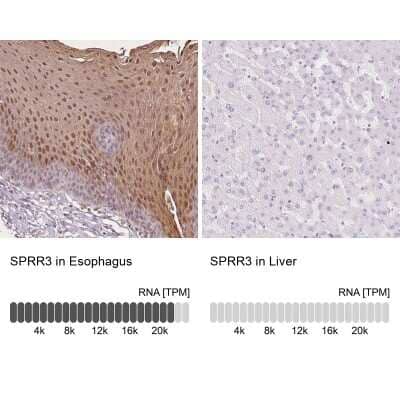 Immunohistochemistry-Paraffin SPRR3 Antibody