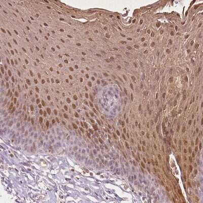 Immunohistochemistry-Paraffin SPRR3 Antibody